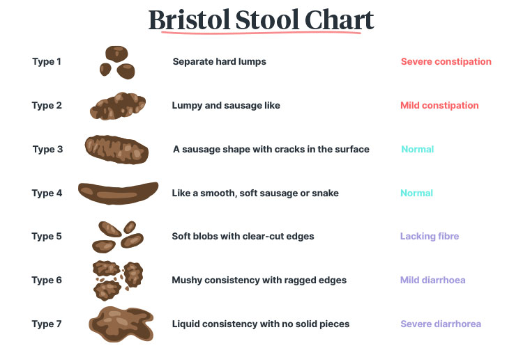 Color of stool with diverticulitis. Diverticulitis Stool Changes ...