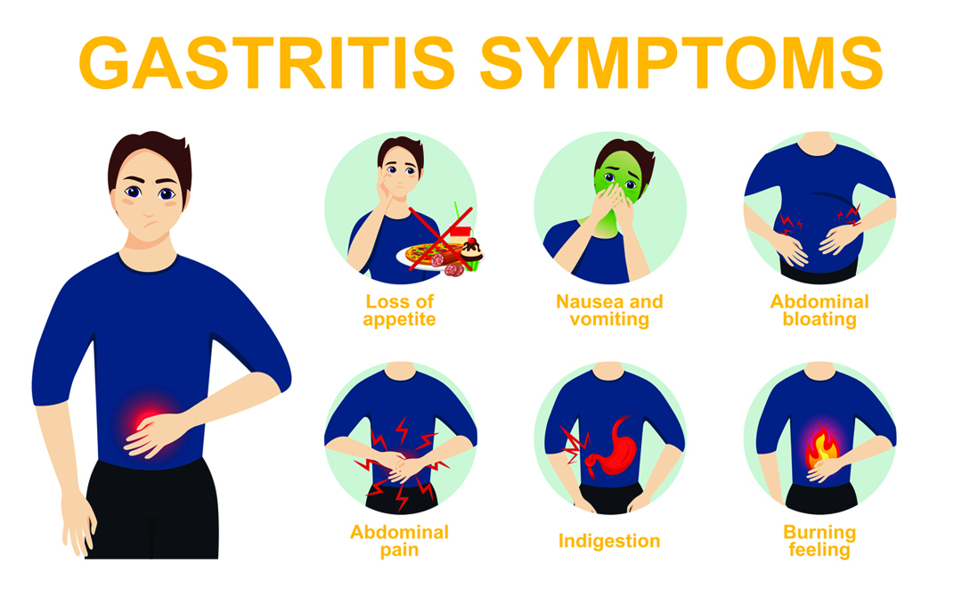 Como prevenir el gastritis