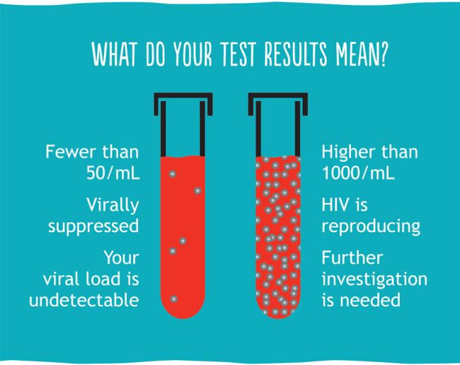 does-aids-show-up-in-a-normal-blood-test-can-a-normal-blood-test