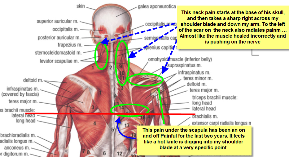 Tingling In Left Side Of Neck And Shoulder Symptoms Causes Diagnosis 