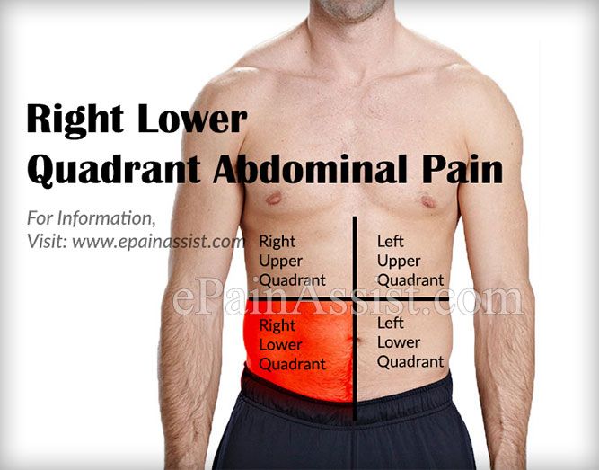 diverticulitis-right-side-pain-diverticulitis-symptoms-and-causes