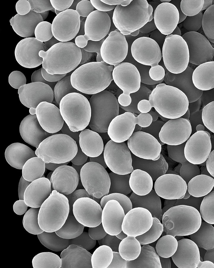 Споры candida. Кандида альбиканс микроскопия. Кандида альбиканс под микроскопом. Saccharomyces cerevisiae микроскопия.