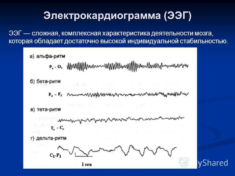 Центральная ээг