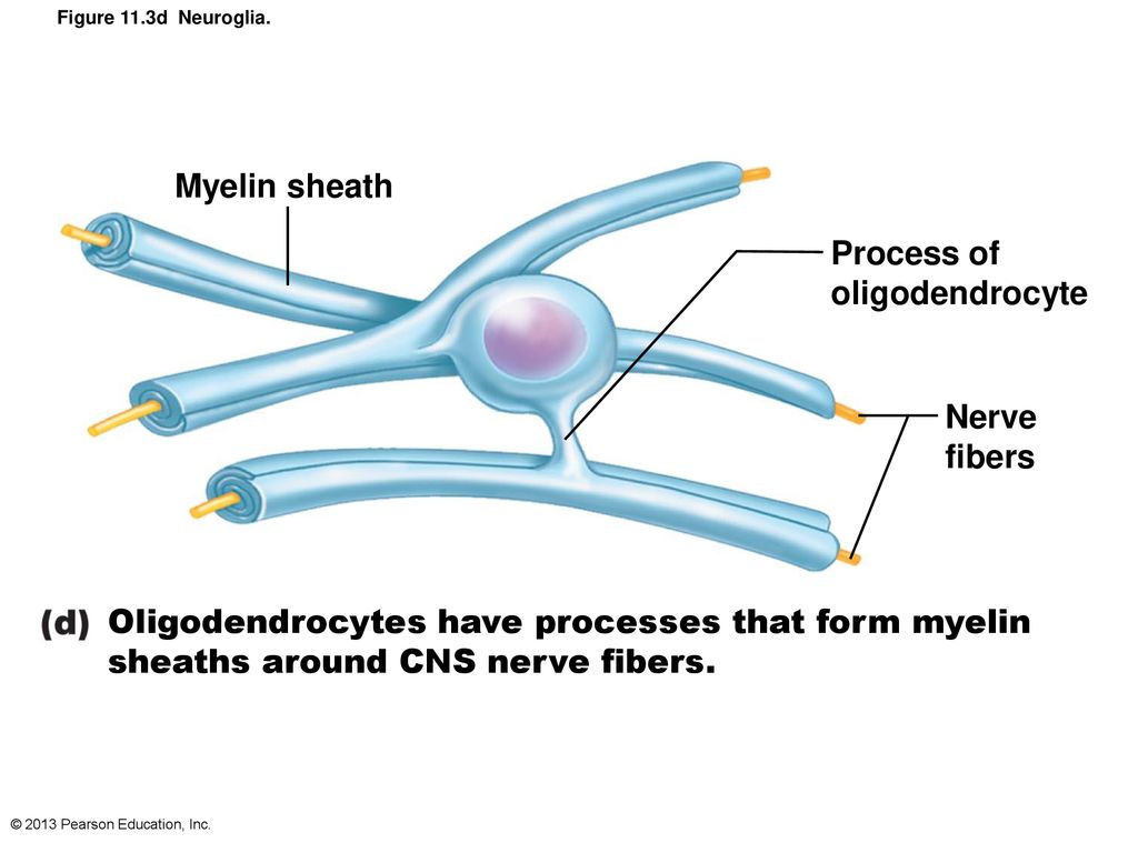 Myelin sheath destruction: Myelin Sheath Destruction in MS, Symptoms .