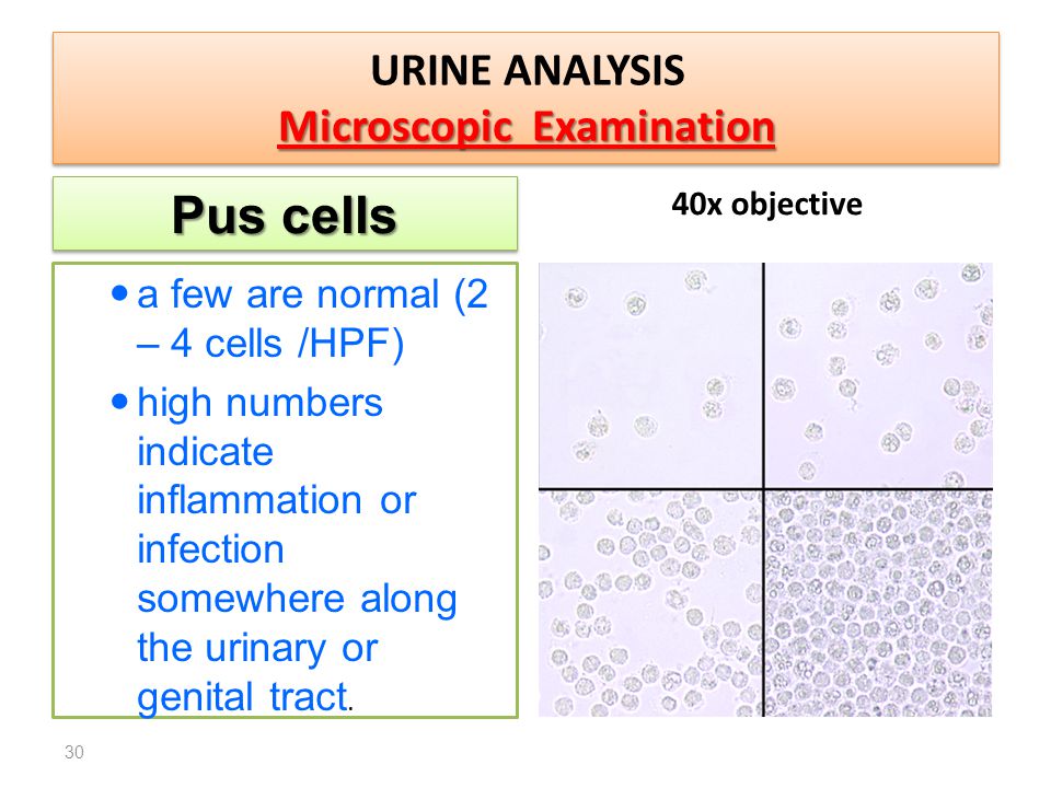 Condition means. Normal urine Analysis. General urine Analysis. Common urine Analysis. Urine microscopic examination.