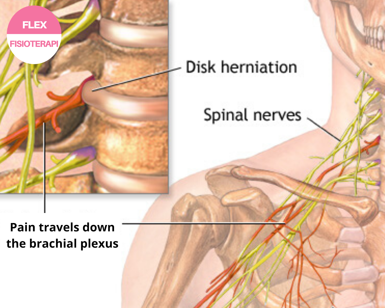 Повредили нерв после. Нервные корешки шейного отдела позвоночника. Нервы в шейном отделе позвоночника. Нерв в шейном отделе позвоночника. Нервы от шейного отдела.