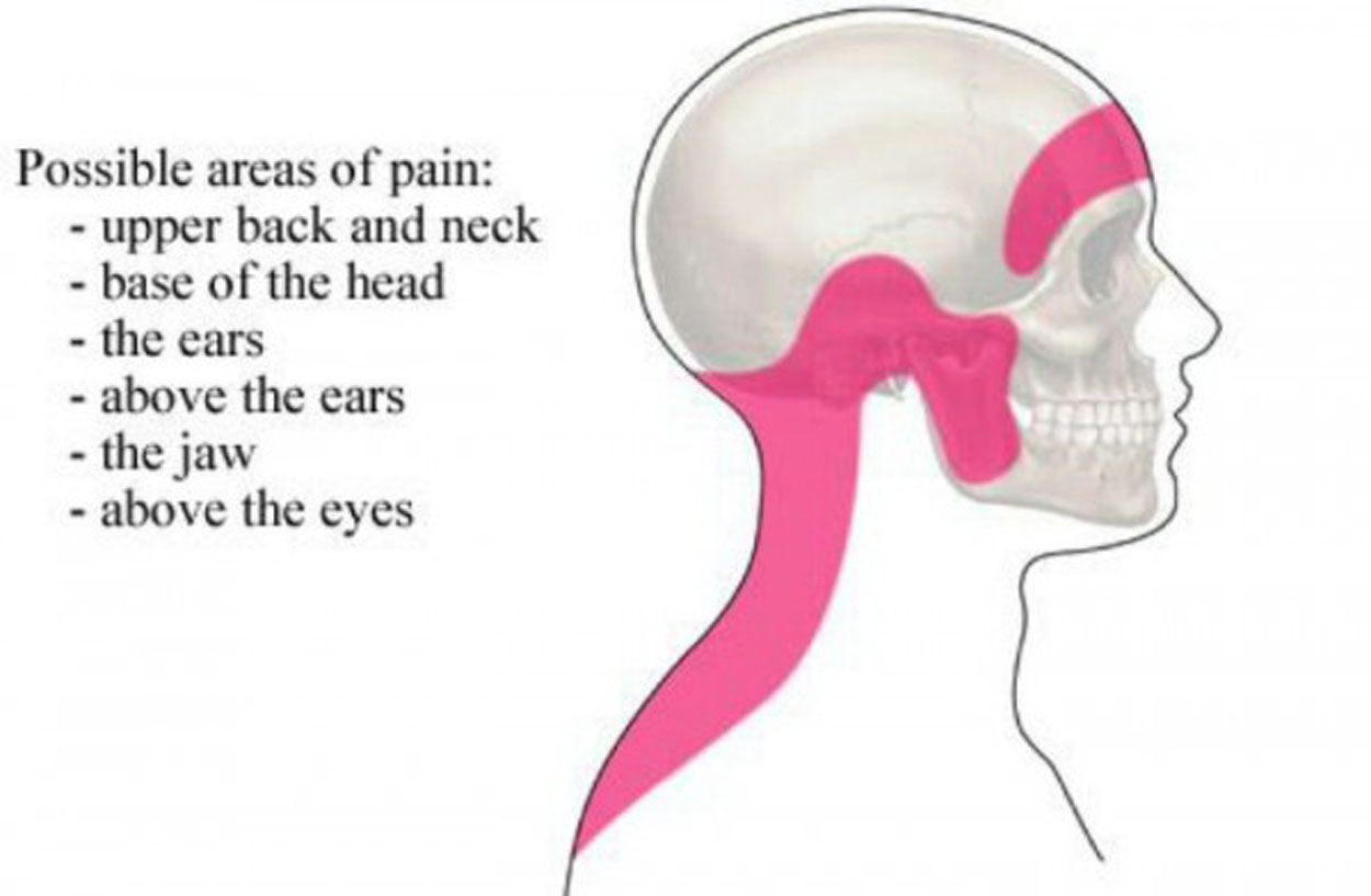 Песня голова шея. Pain in the Neck. Голова и шея символ. Tension headache. Head Pain headaches.