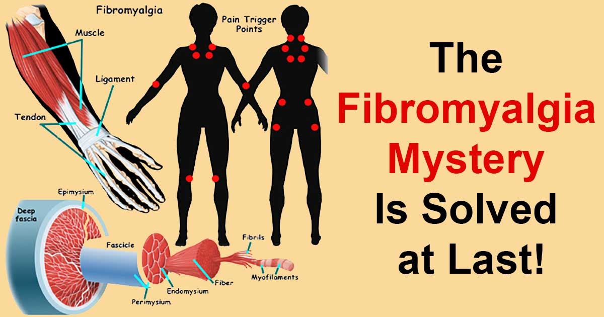 Fibromyalgia and hives: Fibromyalgia Rash: Pictures and Treatment