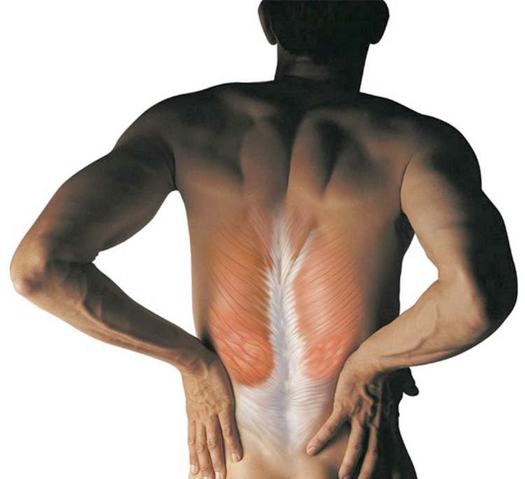 Свело поясницу. Болят мышцы поясницы. Спазм мышц спины. Спазмированная мышца в спине.