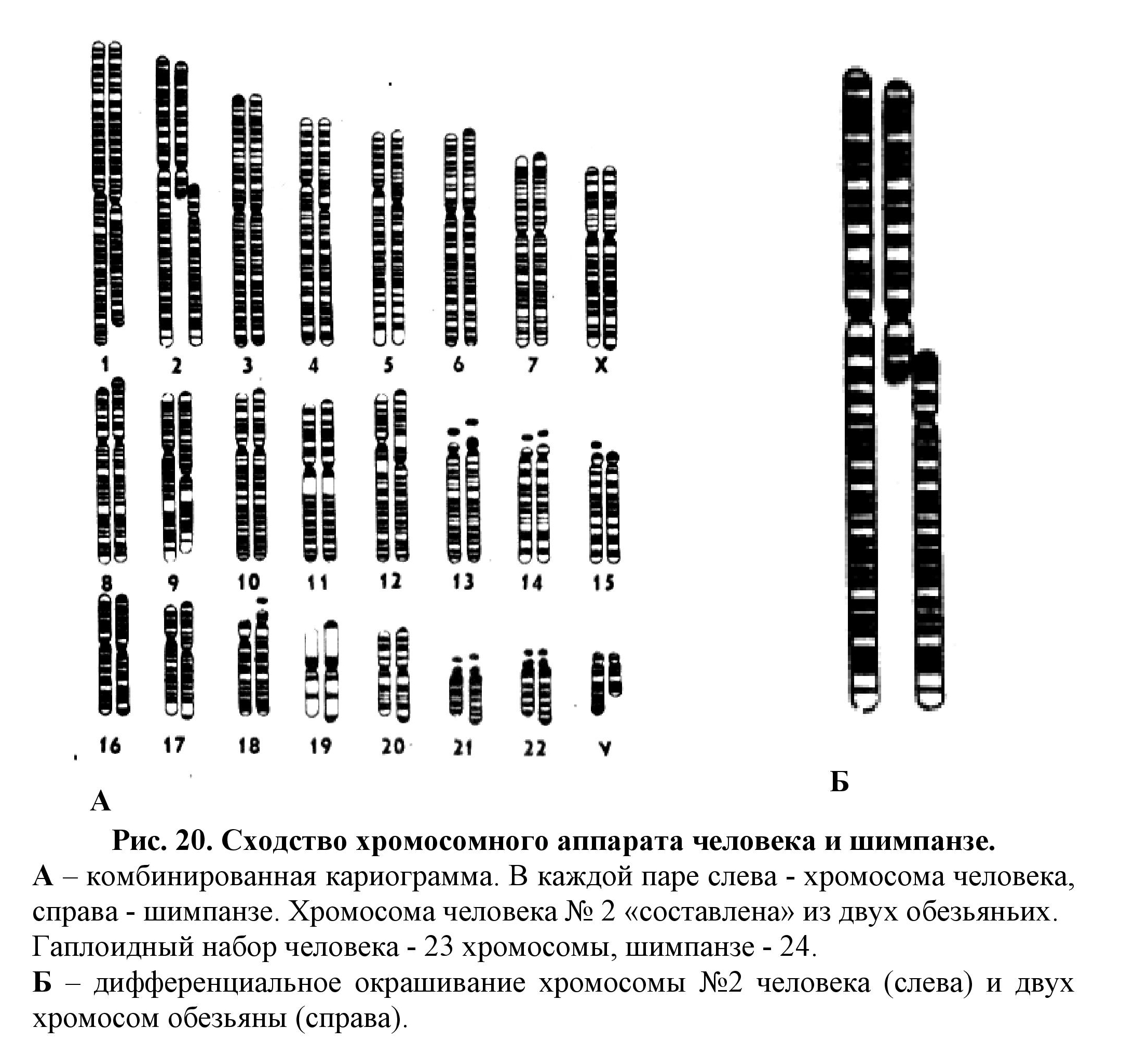 2 Y Chromosome What Is Xyy Syndrome Symptoms Causes Diagnosis Treatment And Prevention 