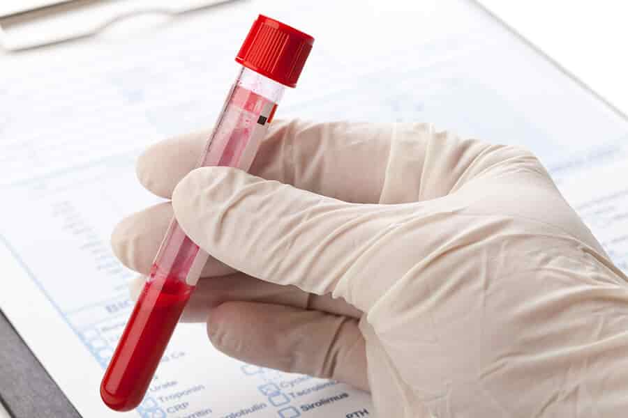 trace-intact-blood-urine-urine-test-definition-disease-detection-and