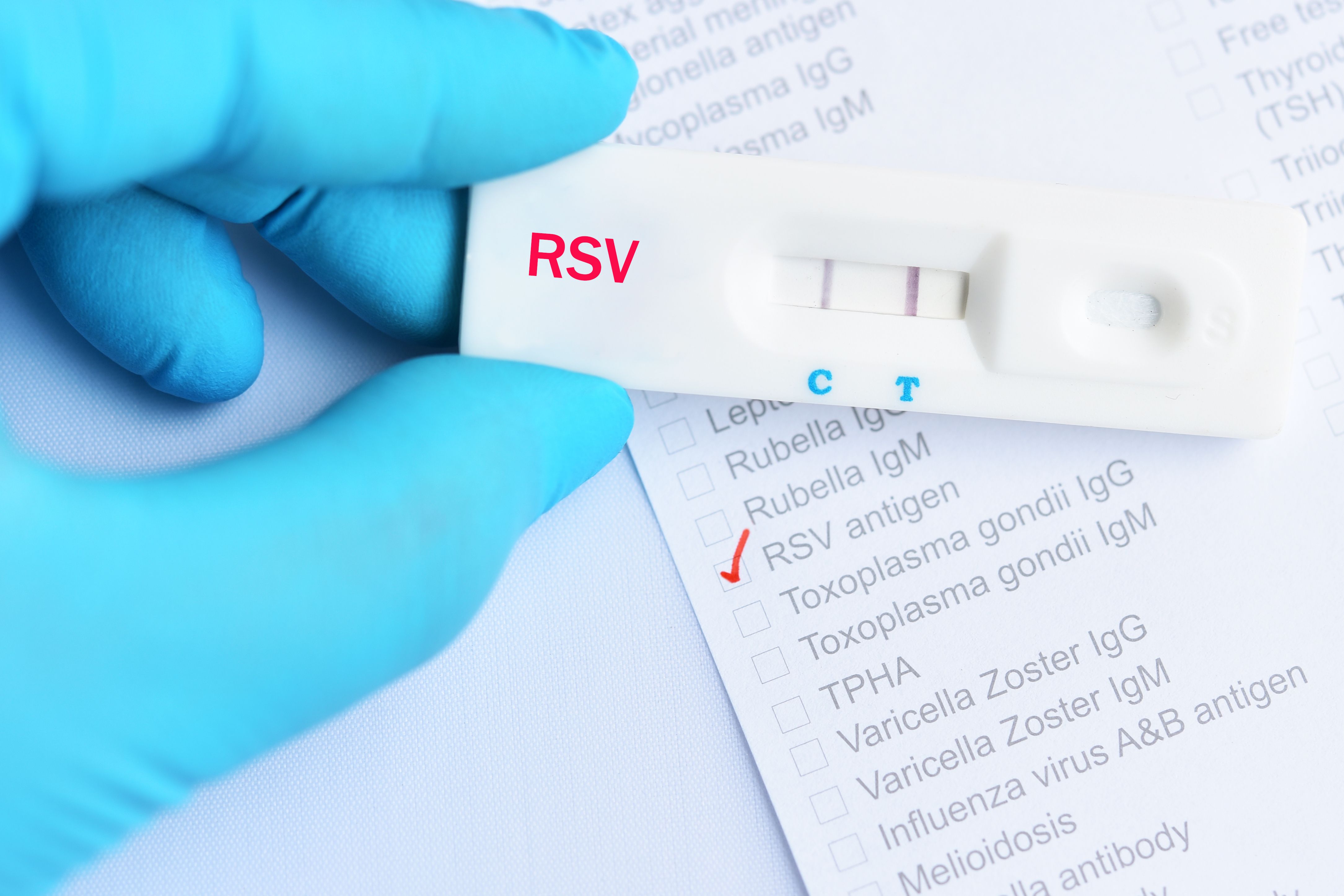Малярия тесты с ответами для врачей. Тест на ВИЧ. Положительный тест на ВИЧ фото. Тест на ротавирус. Тест на хеликобактер.