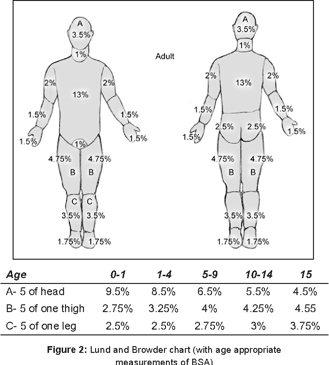 Burn Percentage Diagram Burn Percentage In Adults Rule Of Nines Chart