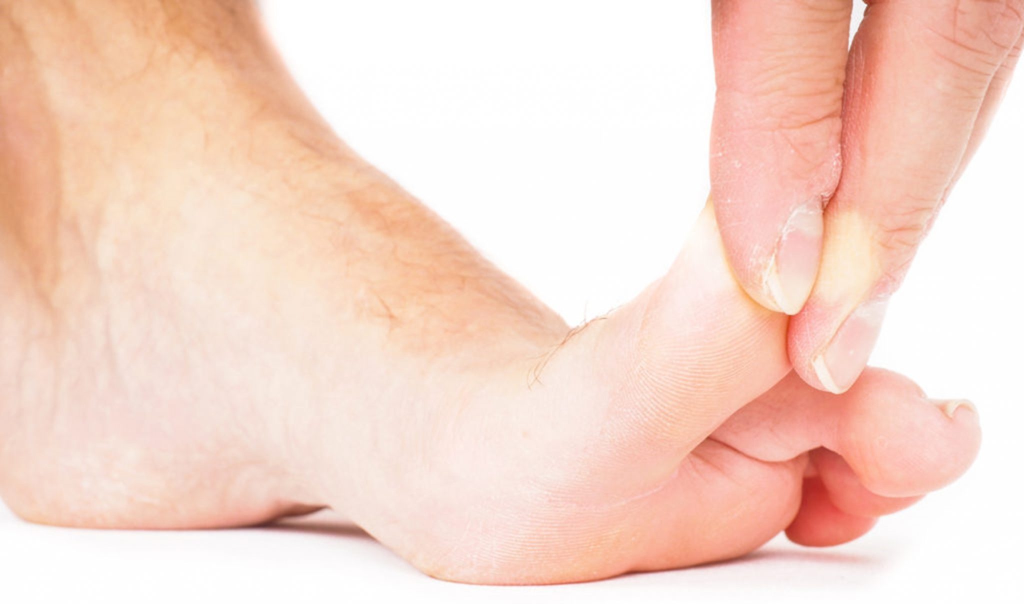 Common Toe Problems 10 Common Foot Problems And How To Manage Them