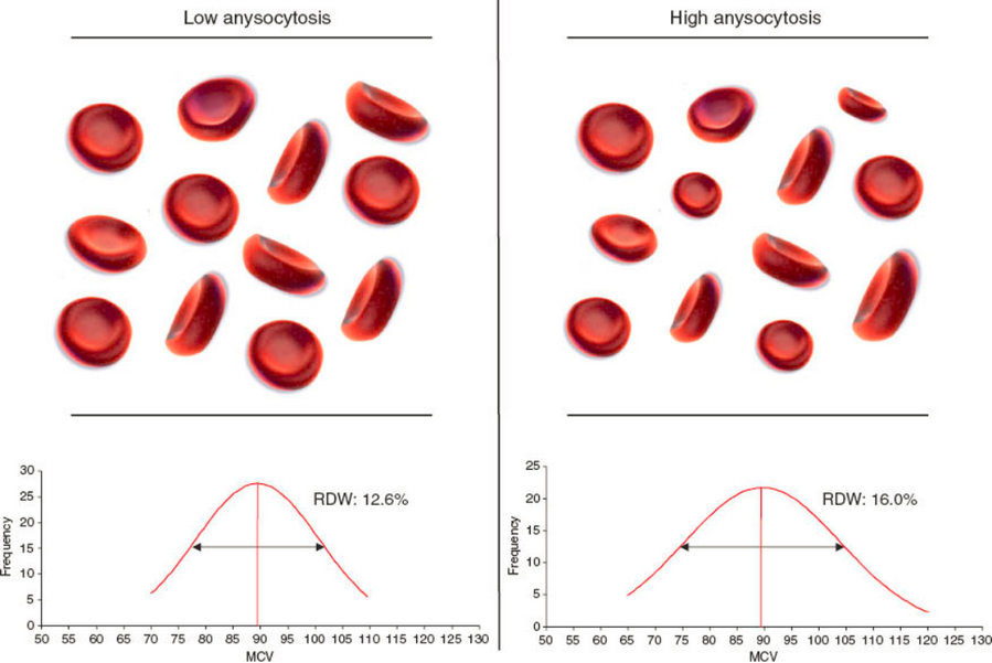 Тест клетки крови. RDW (Red-Cell distribution width). RDW — Red Cell distribution. RDW (Red Cell distribution width) характеризует. MCH MCV RDW MCHC эритроциты.