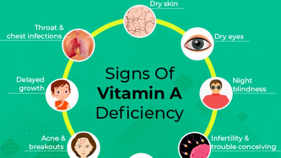 Vitamin deficiency. Vitamin d deficiency.