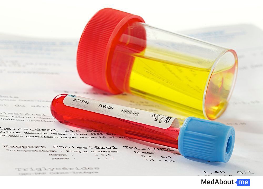 What Does Trace Intact Blood In Urine Mean Pregnancy