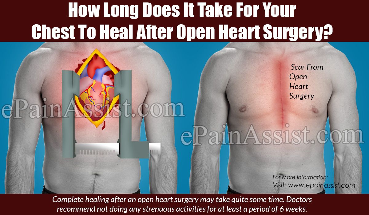 Surgery перевод. Вскрытие грудной клетки при операции на открытом сердце фото. Open Heart перевод. Ощущения после операции на открытом сердце.