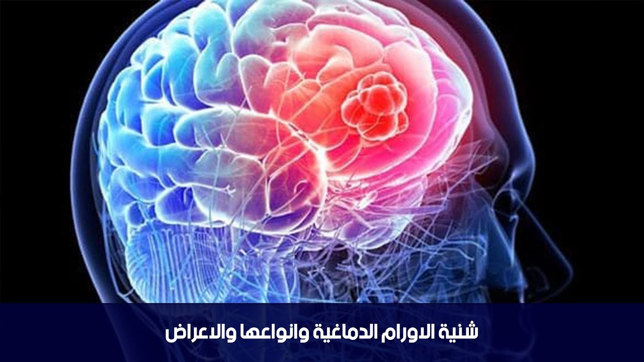 Институт лечения мозга