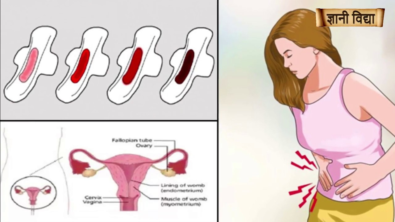 Цвет Выделений Перед Менструацией