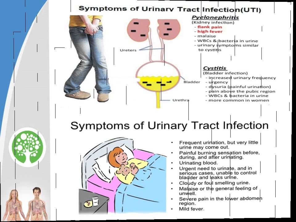 How to fix uti at home The request could not be satisfied