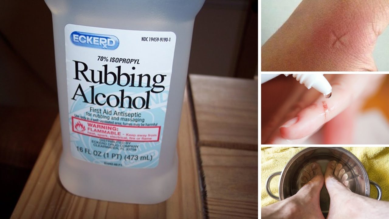 Rubbing clubbing. Rubbing alcohol. Rubbing alcohol 90 %. Rubbing alcohol Nima. Turpentine and rubbing alcohol.