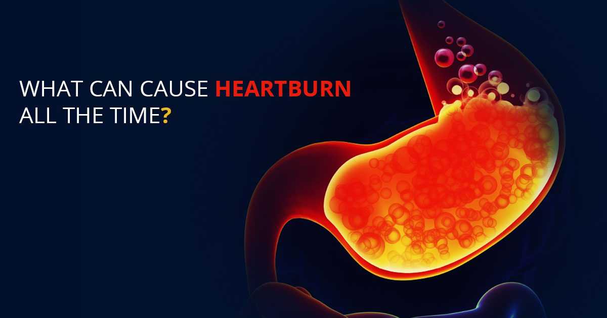 heartburn-causes