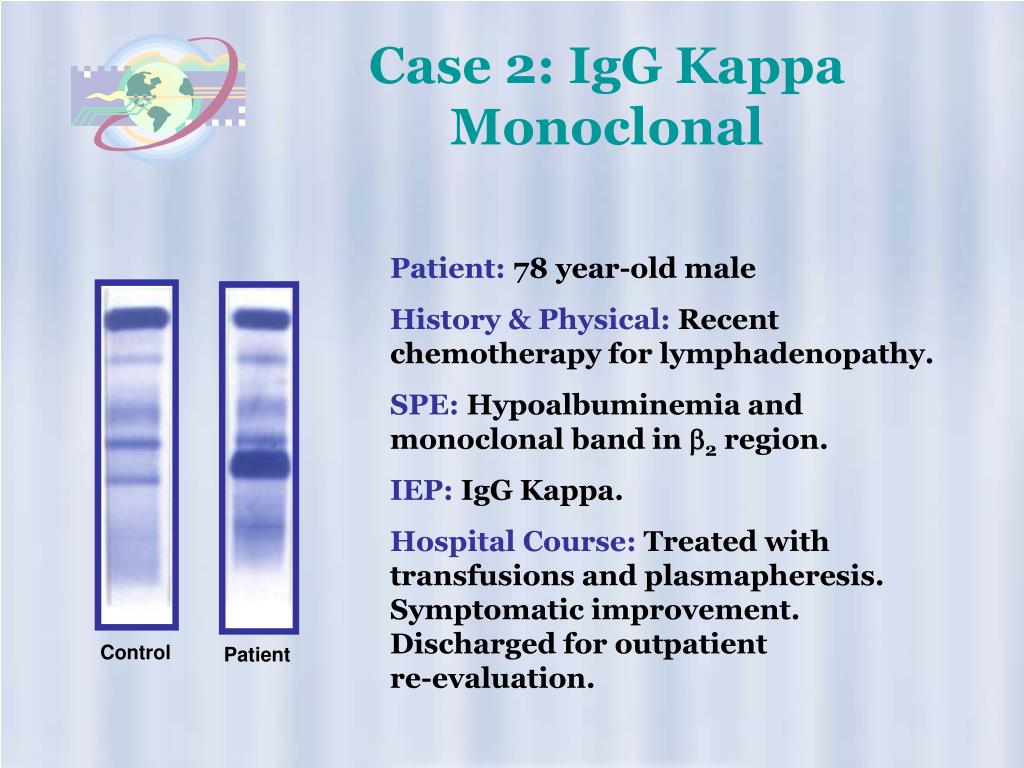 what-is-igg-kappa-types-of-multiple-myeloma-international-myeloma