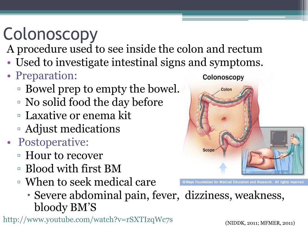 After Effects Of A Colonoscopy Procedure Complications Before During   Colonoscopy L 