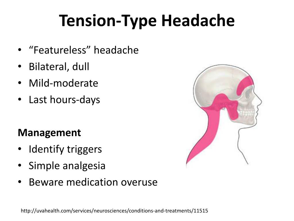 Головная боль переводчика. Tension headache. Tension Type headache. Tension headache Pathophysiology. Types of Hypertension.