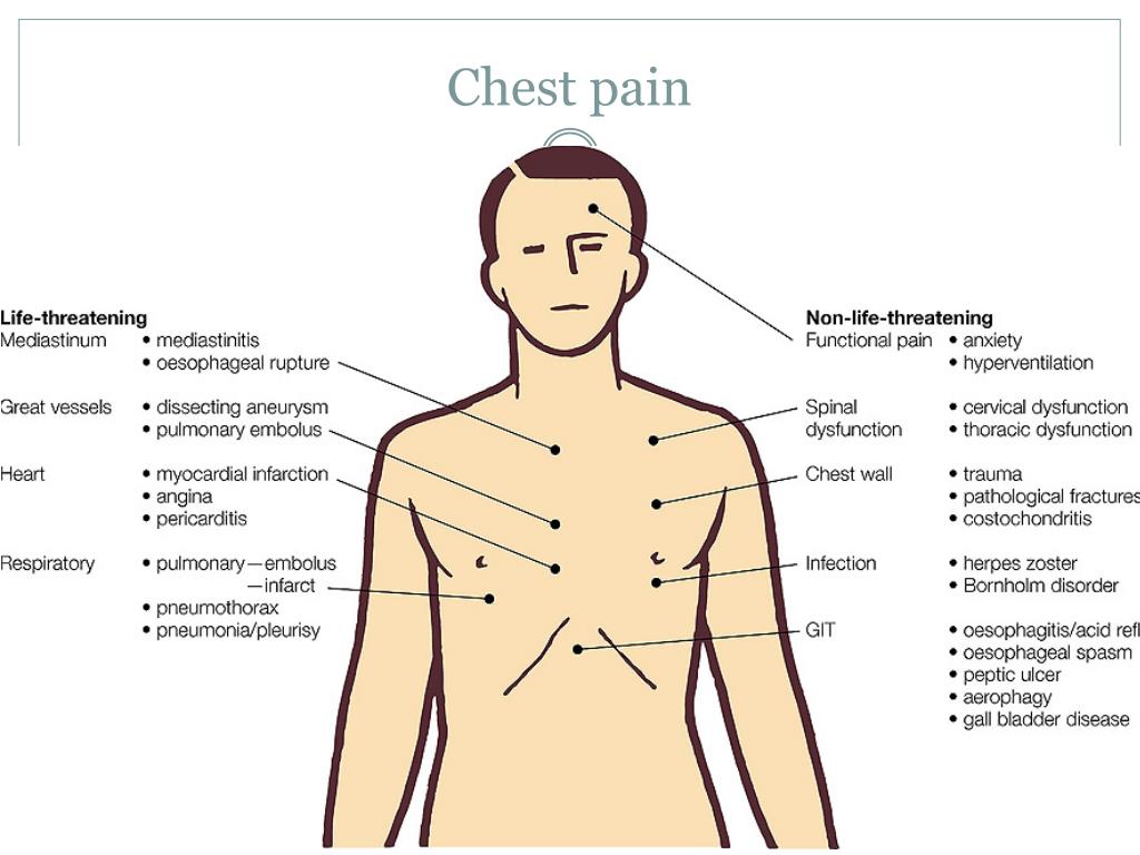 Pain In Left Chest Wall The Request Could Not Be Satisfied