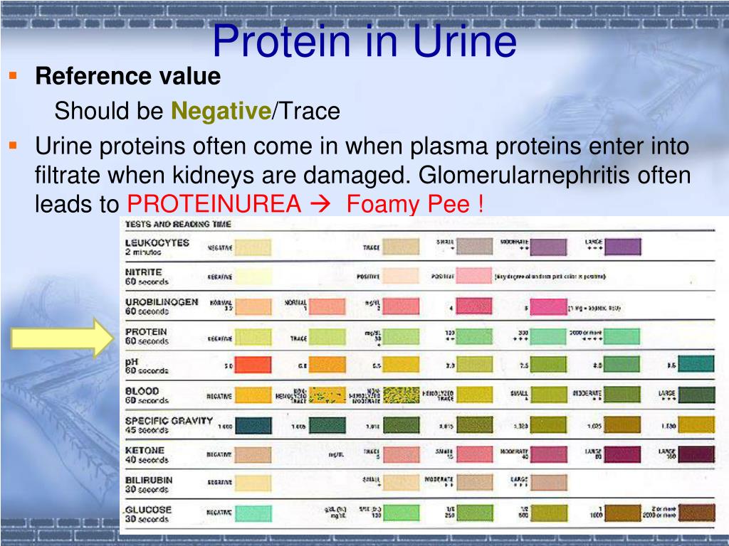 urine-test-blood-trace-intact-blood-in-urine-hematuria-symptoms