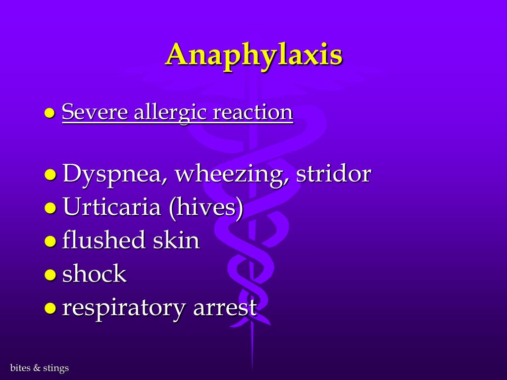 Msg allergy reactions. MSG Sensitivity: Understanding Symptoms ...