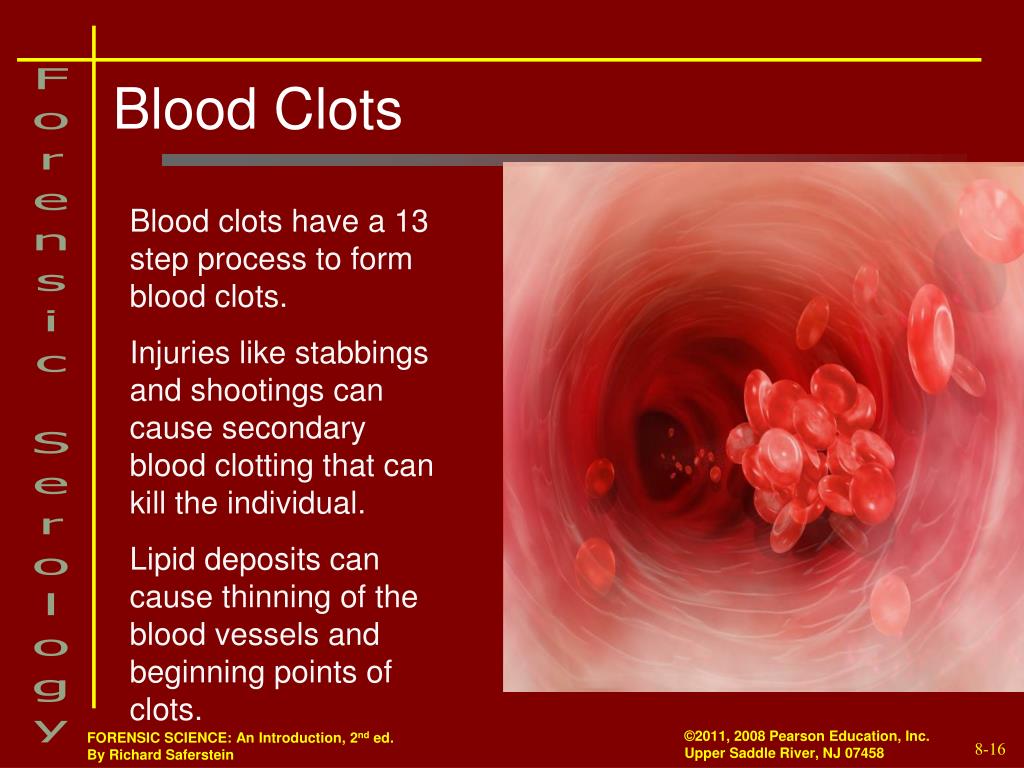  Can Blood Clot Go Away On Its Own Do Blood Clots Go Away On Their Own 