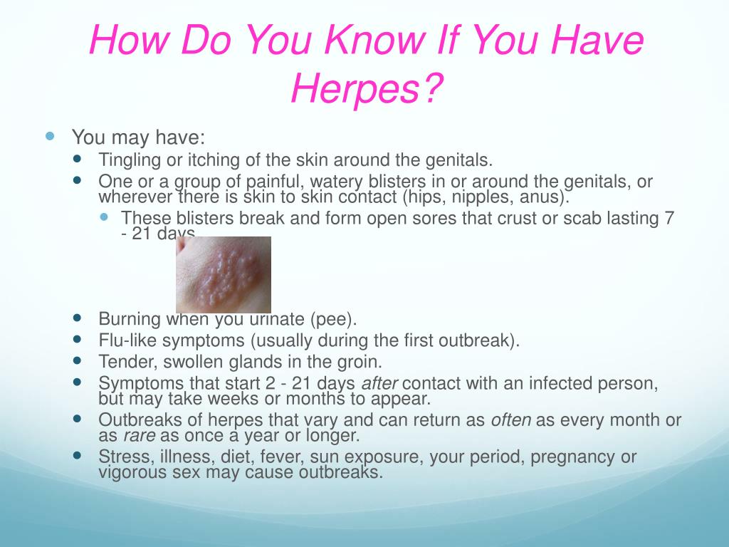 Can Herpes Make Your Neck Hurt