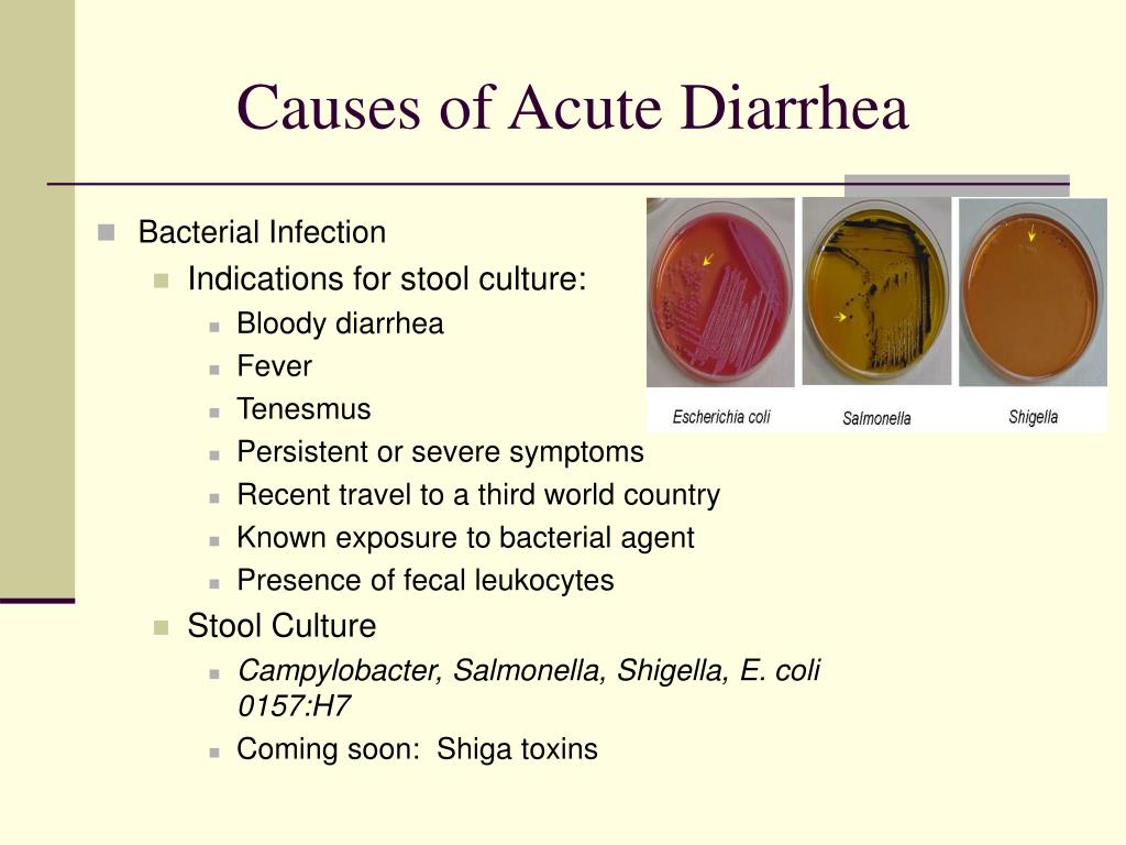 Cause of diarrhea for 3 days: Diarrhea – Symptoms and causes