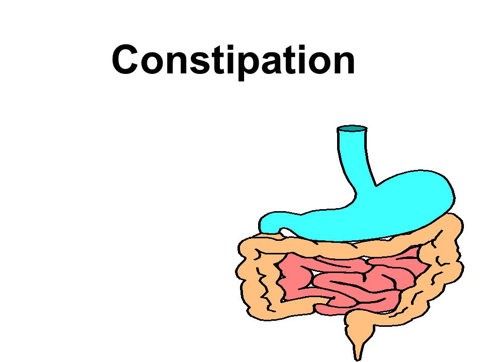 Обстипация это. Констипация. Констипация кишечника это. Integrative Gastroenterology. How can Irregular bowel Movements be treated?.