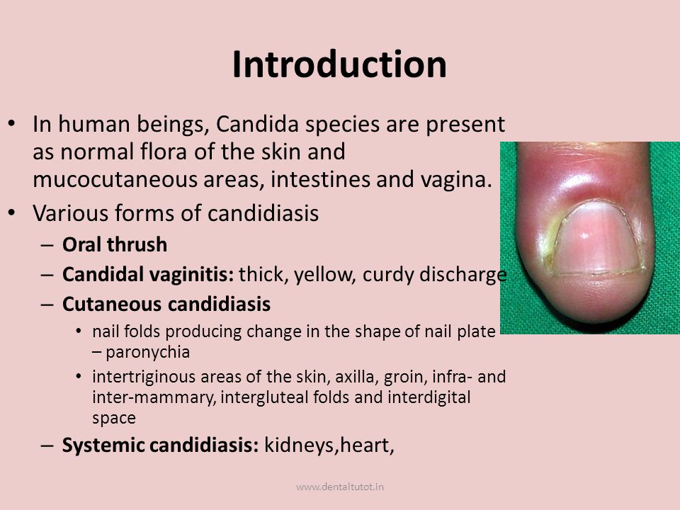 Cetosis y candidiasis