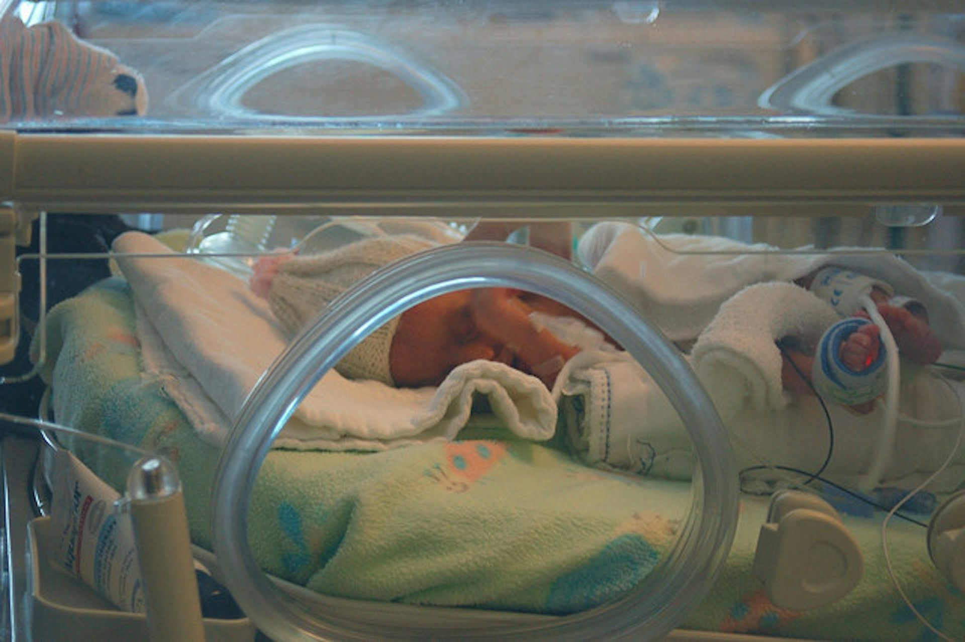 Недоношенные дети роды. Недоношенные дети в роддоме. Недоношенный новорожденный. Недоношенный ребёнок в инкубаторе.