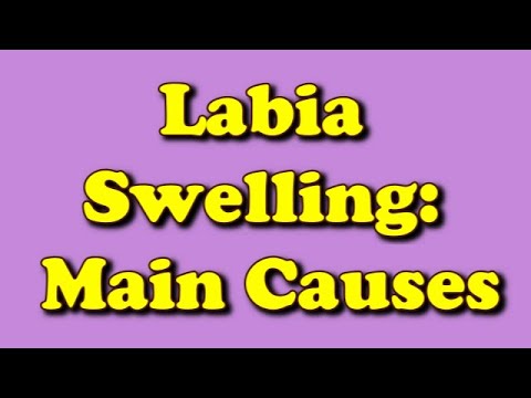 Swollen Majora Labia Swollen Labia Causes Symptoms And Treatment