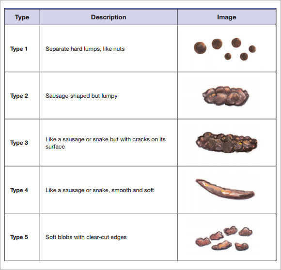 Stool color guide: Stool Color Chart, Meaning, Texture Changes, Size ...