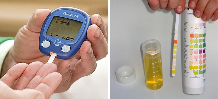 Тест крови в домашних условиях. Измерение сахара. Сахарный диабет измерение. Измерение уровня Глюкозы. Измерение сахара в крови глюкометром.