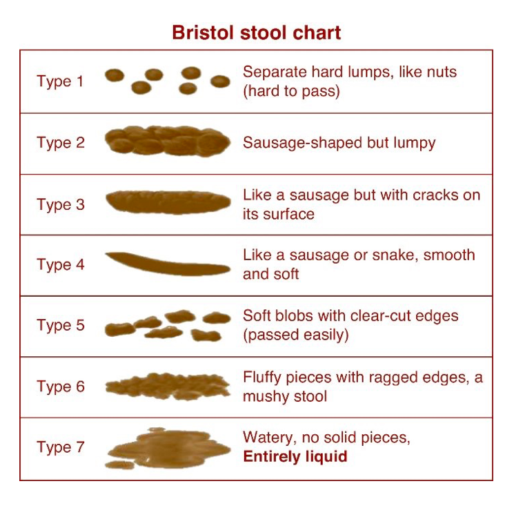 Stool color guide: Stool Color Chart, Meaning, Texture Changes, Size ...
