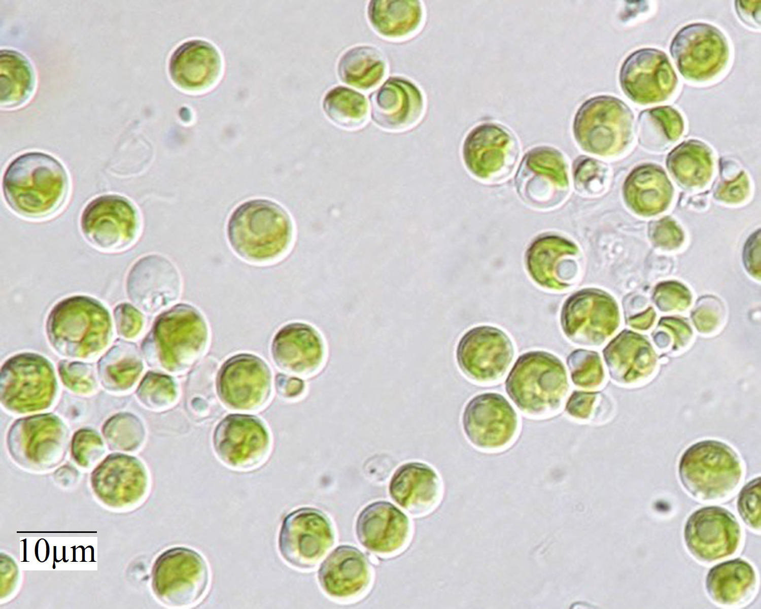 Культивирование одноклеточных водорослей. Микроводоросли хлорелла. Одноклеточная водоросль хлорелла. Хлорелла вульгарис. Зеленые водоросли хлорелла.