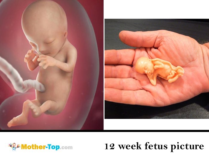 12 неделя плохо. Абортус в 12 недель беременности.