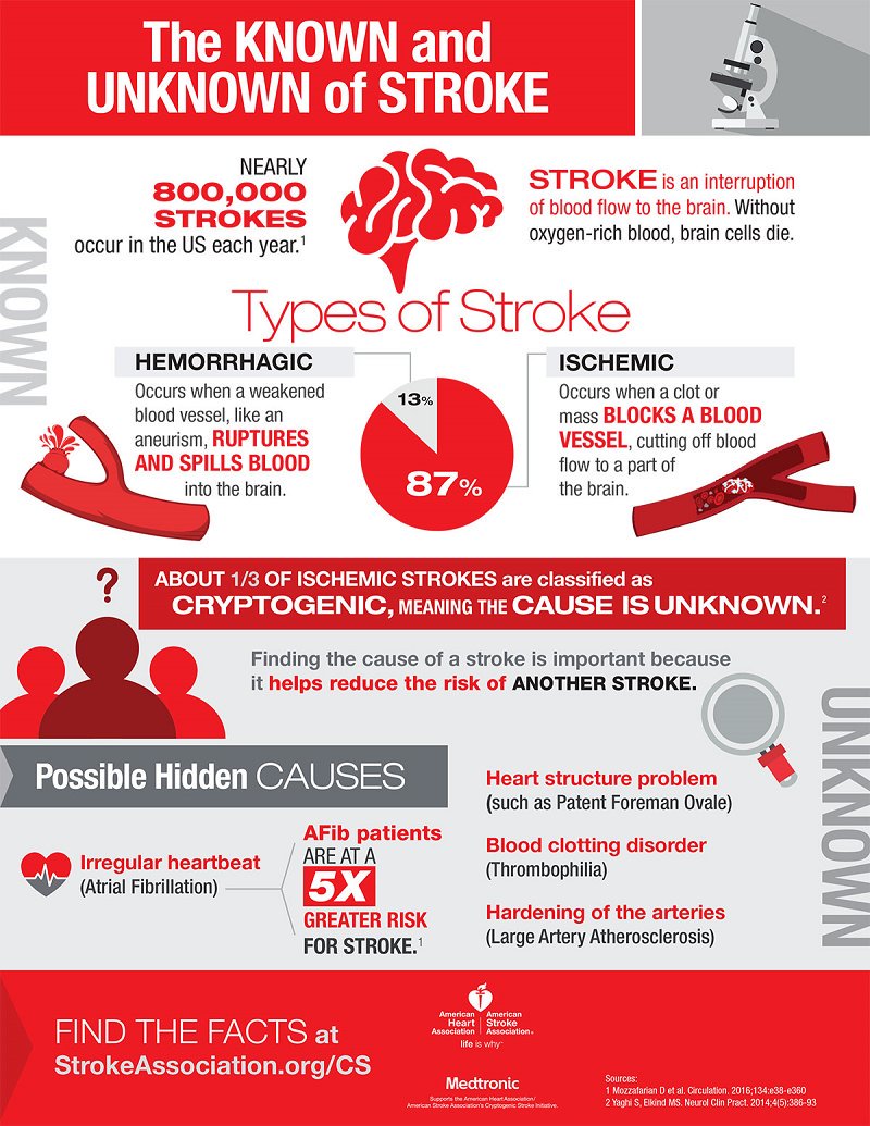 causes-of-hardening-of-the-arteries-symptoms-causes-diagnosis-and