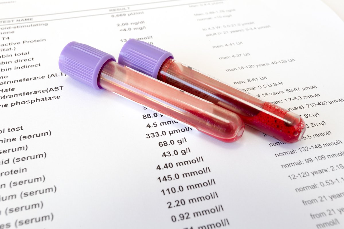 Blood test results hemoglobin: Hemoglobin test – Mayo Clinic