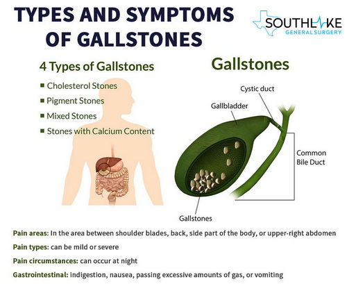 Foods That Irritate Gallbladder Gallbladder Diet Foods For Gallbladder Problems