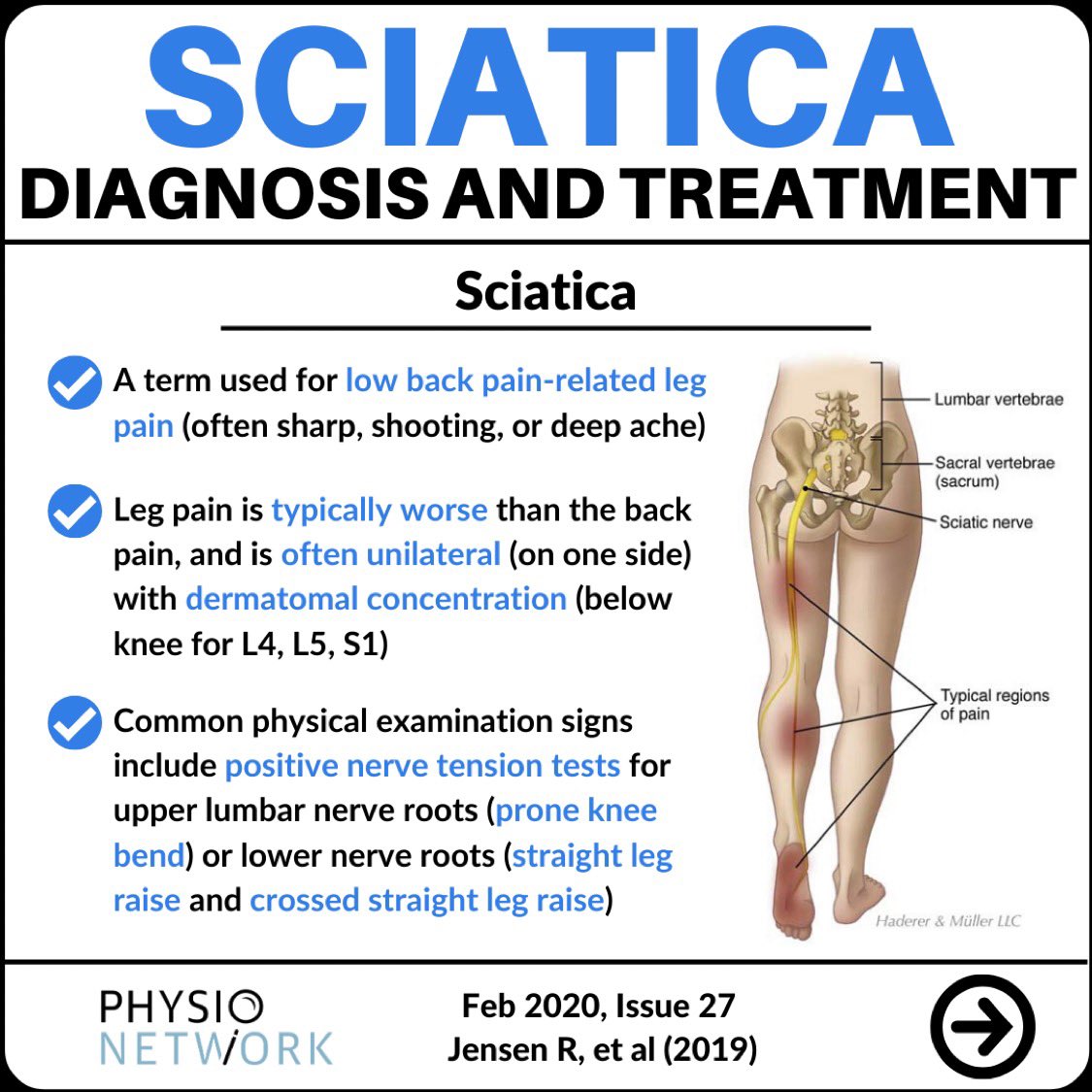 Sciatica перевод.