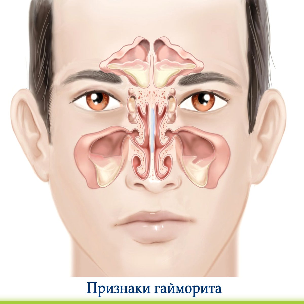 Cellulitis Symptoms Nose The Request Could Not Be Satisfied